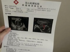 女孩18岁卖卵19岁代孕流产，两家医院均否认参与，昆山卫健委回应
